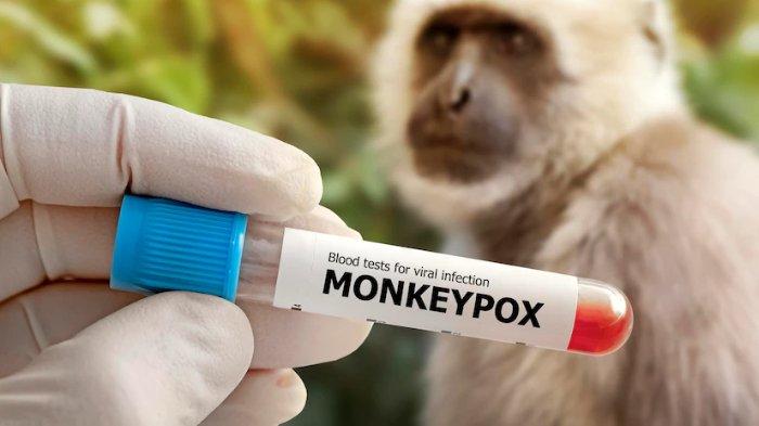 Mengapa Cacar Monyet Jadi Ancaman Global Menurut WHO? Kenali Gejala Monkeypox dan Penularannya